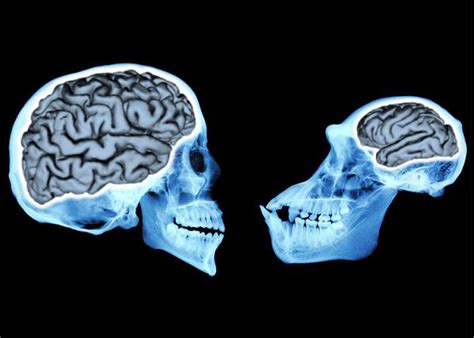 Human brains show larger-than-life activity at moment of death 